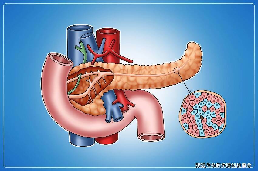 胰腺癌：從確診到死亡僅僅3個月，提醒：4個癥狀，可能是胰腺在求救