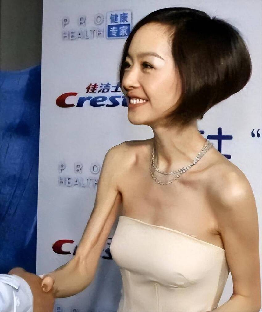 濾鏡下是美女，現實中是「女鬼」！這些瘦到病態的明星，真恐怖