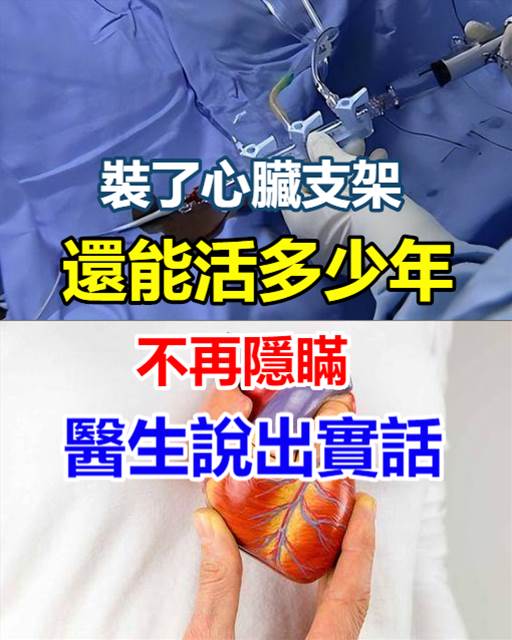 以為「裝了心臟支架」就一勞永逸！醫生揭秘「還能活多少年」不再隱瞞：說出四大實話