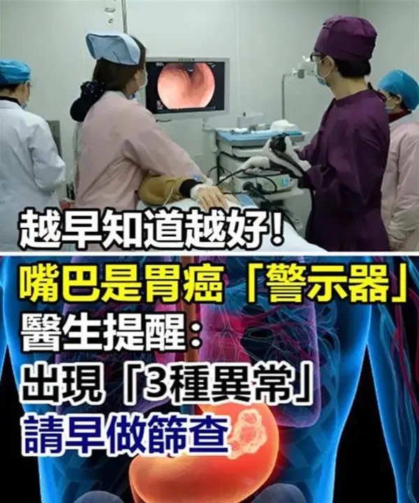 越早知道越好！嘴巴是胃癌的「警示器」醫生提醒：出現「三種異常」請早做篩查