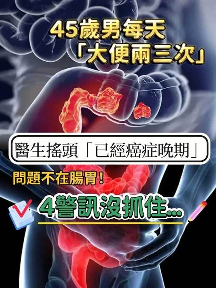 才45歲！他每天「大便兩三次」以為消化好，醫生搖頭「已經癌癥晚期」四異常沒注意