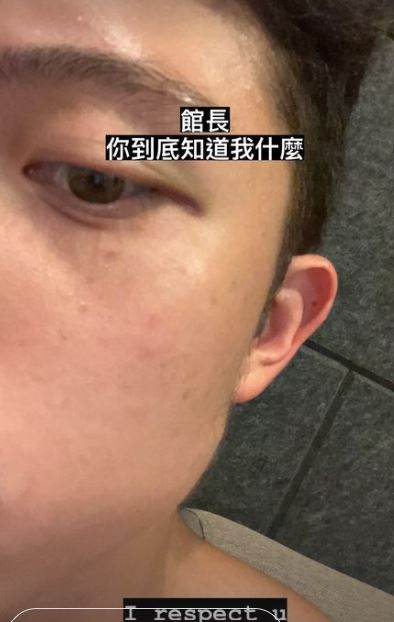 館長不忍對孫安佐發言　嘆：很多巨嬰！狄鶯也反擊說話了