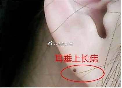 命理師直言：孩子身上若有這4種痣，長大後多半福氣深厚、前途不簡單！