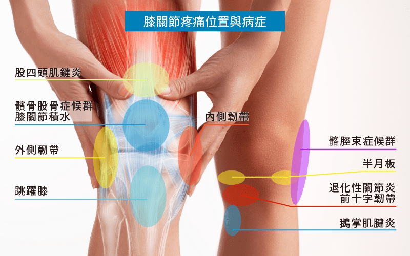 膝蓋不好走路總是疼痛？每天做「3個小動作」讓你的膝蓋越用越年輕