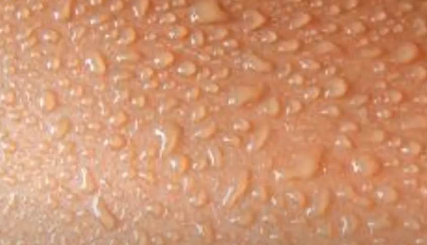 醫生警告：睡覺出現這癥狀是中風前兆！千萬別忽視，趕緊治療還不遲