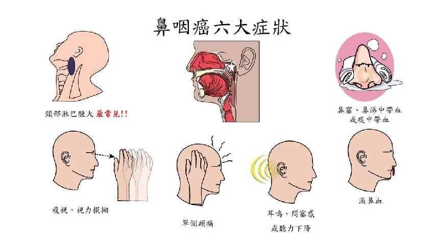 不是開玩笑，這種魚自帶癌細胞， 家裏有的趕緊扔進垃圾桶