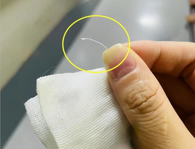 孩子被魚刺卡喉,媽媽60秒機智處理,被醫生稱讚:很及時,很專業