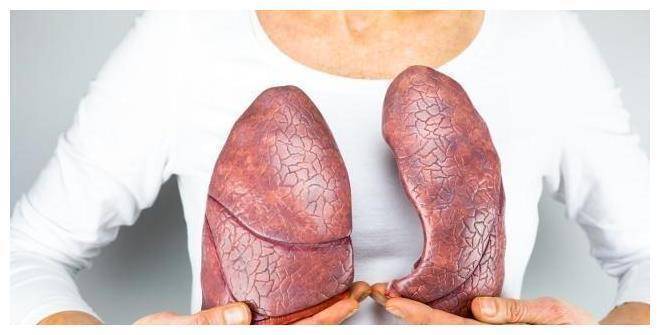 肺癌都是「拖」出來的？醫生：身上若有「2痛1凸」，建議查CT