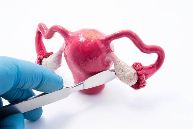 宮頸癌多是「拖」出來的，女人下半身若有4處異常，趁早就醫！