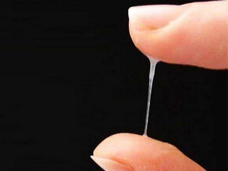 宮頸癌多是「拖」出來的，女人下半身若有4處異常，趁早就醫！