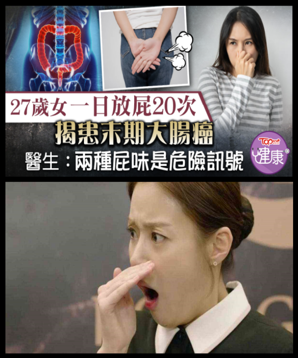 27歲女一天放20次屁　「就醫已是癌末」醫警告：2種屁味要小心