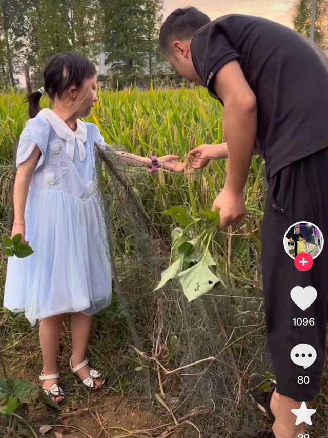 6歲女孩吃火鍋被燒成重傷，13次手術后臉長滿「大鬍子」浴火重生