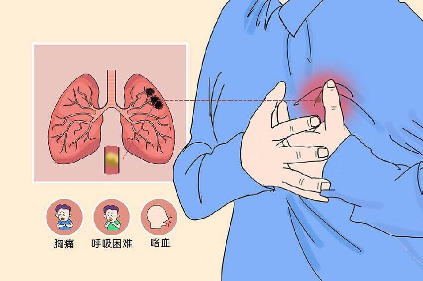 46歲女子「僅僅是骨折」，手術順利竟「突然死亡」，屍體解剖結果醫師都傻眼了