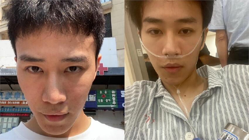 才剛暴紅…28歲大長腿男星驚爆「罹肺癌末期」！揭真實病況「已轉移」：很不樂觀