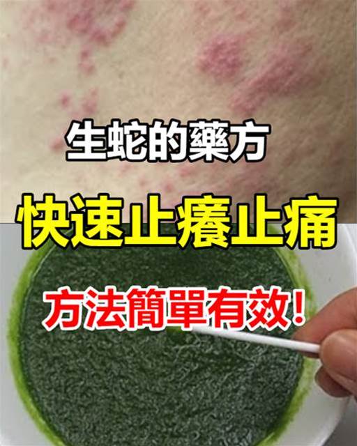 生蛇的藥方,快速止癢止痛,方法簡單有效!