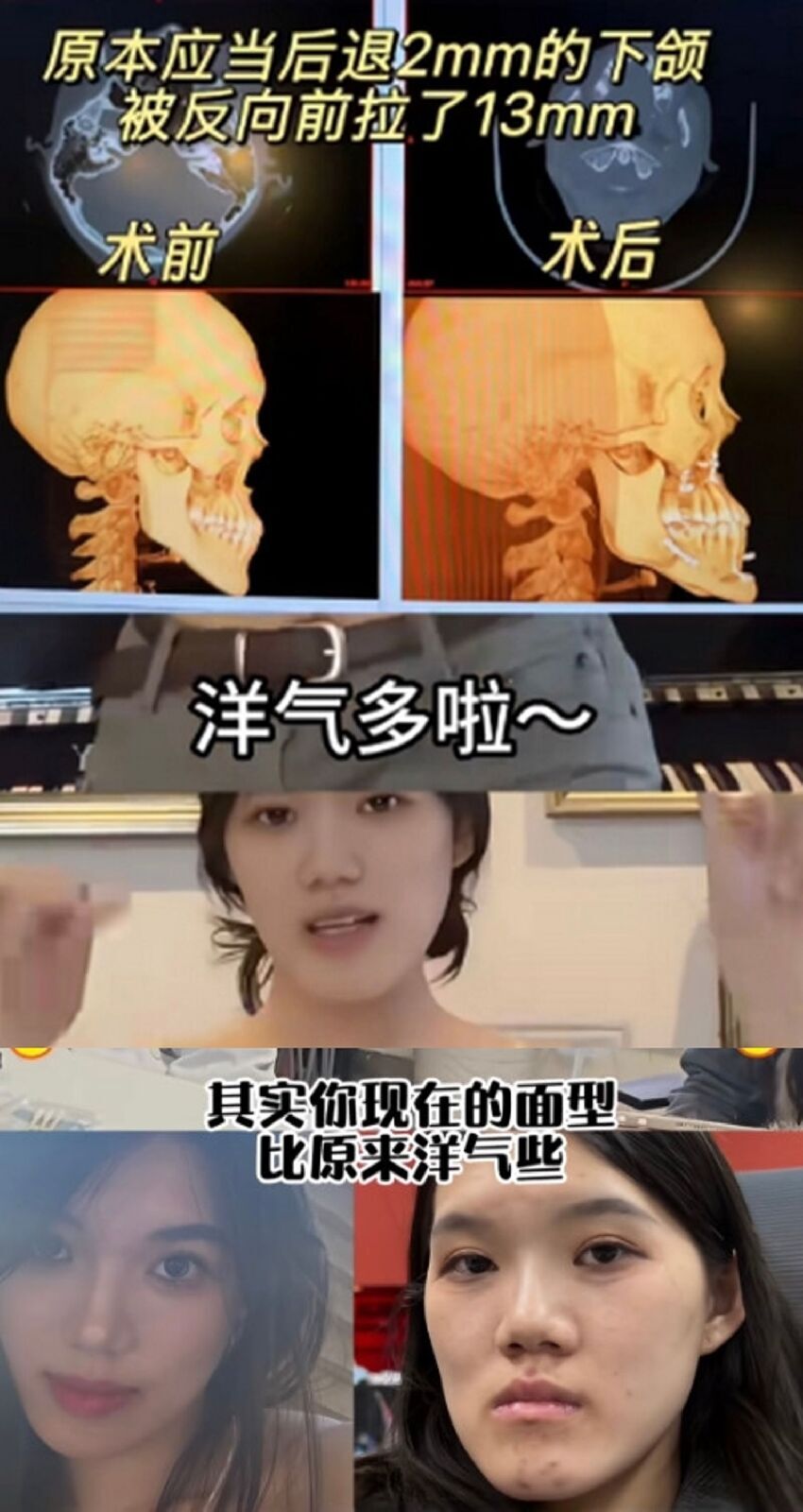 整容變毀容！正妹淚喊「撞臉朱元璋」名醫冷回：這叫洋氣臉