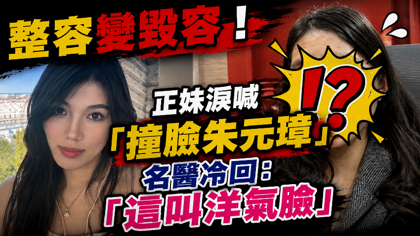 整容變毀容！正妹淚喊「撞臉朱元璋」名醫冷回：這叫洋氣臉