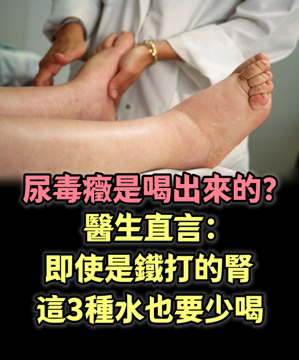 尿毒症是喝出來的？醫生直言：即使是鐵打的腎，這3種水也要少喝