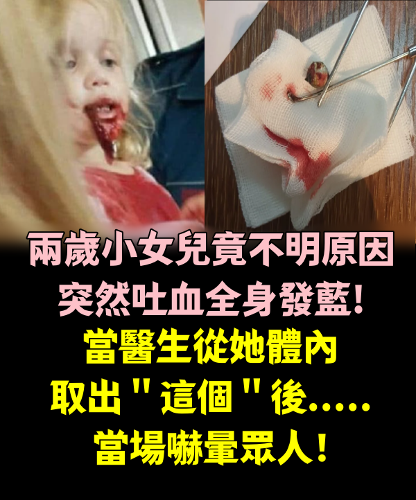 兩歲小女兒竟不明原因突然吐血全身發藍！當醫生從她體內取出＂這個＂後.....當場嚇暈眾人！