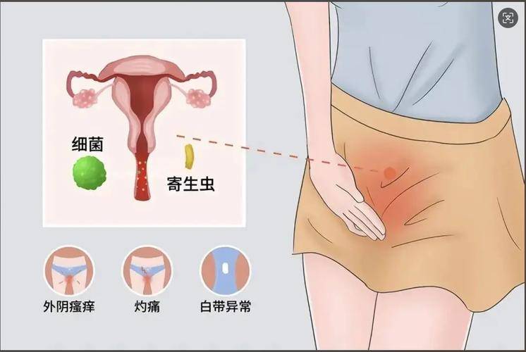 HPV感染不只是私處癢！醫生：這兩處長出疙瘩，八成是感染了