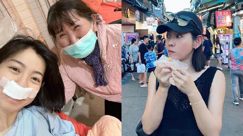 突發！米可白住院插管，緊急狀況曝光