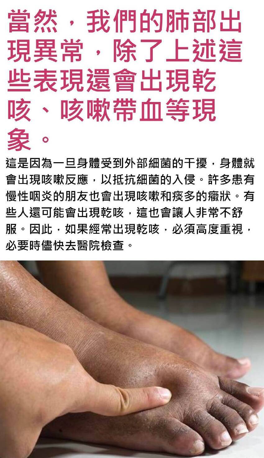 肺部有癌，雙腳先知？同時出現 4 現象，癌癥或已到了中晚期