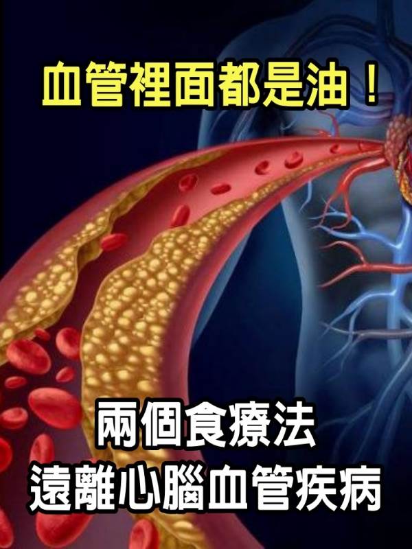 血管裡面都是油！記住2個食療法「膽固醇」降得又快又簡單　暢通不堵塞：遠離心腦血管疾病