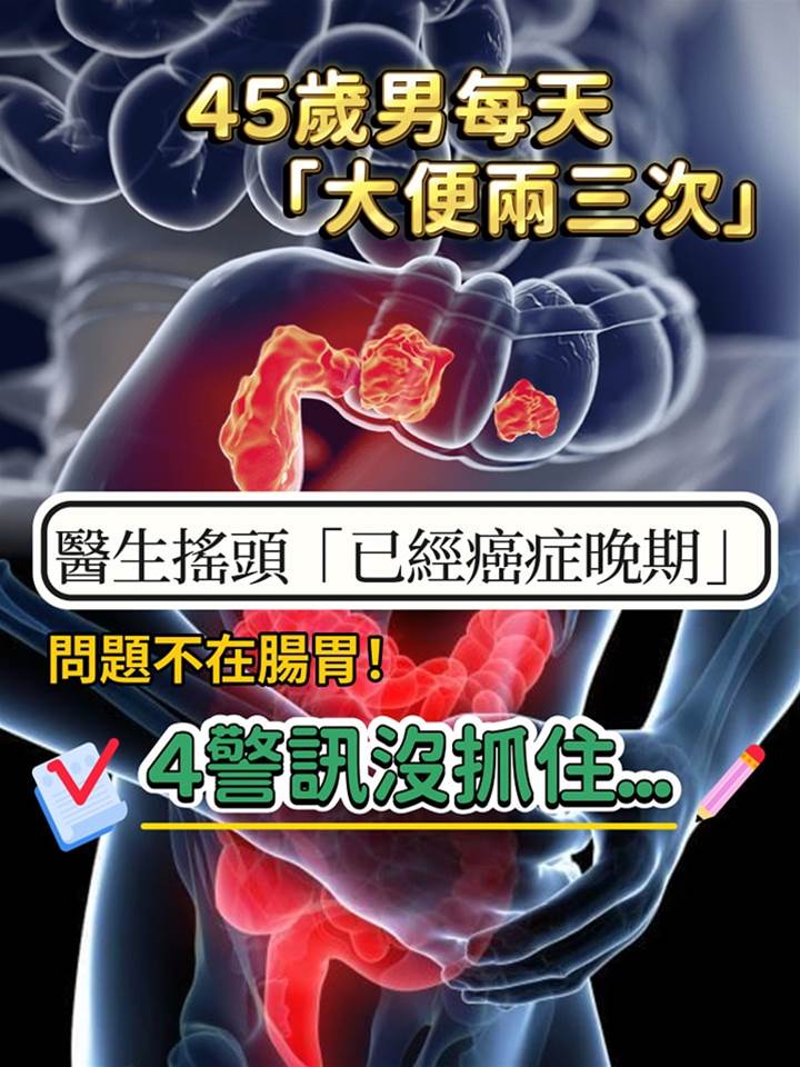 才45歲！他每天「大便兩三次」以為消化好，醫生搖頭「已經癌癥晚期」4異常沒注意