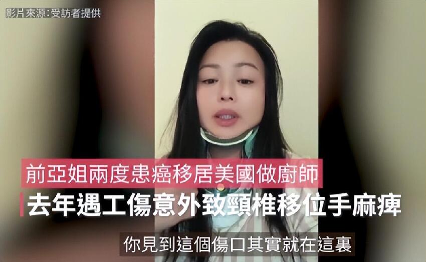 49歲女星「婚姻失敗又兩度患癌」移居美國謀生，餐廳打工被砸傷，治療18個月現狀曝光