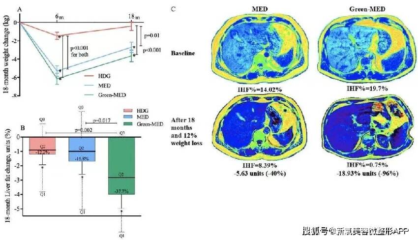 47歲舒淇毀容式近照曝光！滿頭白髮，是婚後8年不幸福嗎？