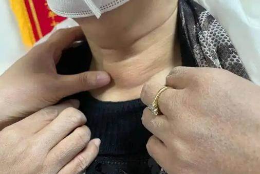 年輕夫妻雙雙查出「甲狀腺癌」！醫生一看嚇喊「兇手是你家熱水壺」：這一款快換掉