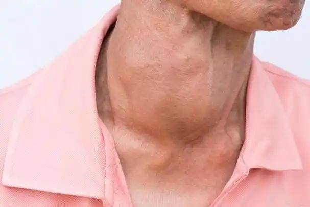年輕夫妻雙雙查出「甲狀腺癌」！醫生一看嚇喊「兇手是你家熱水壺」：這一款快換掉