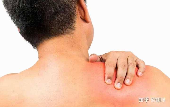 肩膀痛了半年，竟然不是發炎？而是「這種病」，肩膀疼痛者必須注意