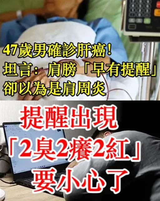 47歲男確診肝癌！坦言：肩膀「早有提醒」卻以為是肩周炎　提醒出現「2臭2癢2紅」要小心了