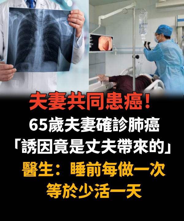 夫妻共同患癌！65歲夫妻確診肺癌「誘因竟是丈夫帶來的」　醫生：睡前每做一次等於少活一天