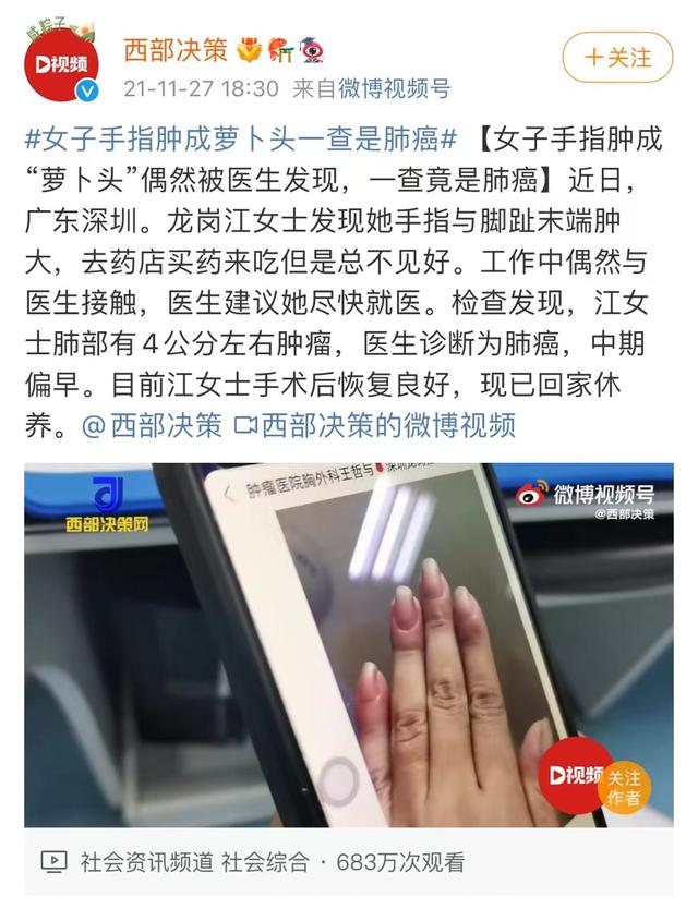 體內有癌，雙手先知！手上出現3個變化，小心是肝癌、肺癌、癌王來臨信號！