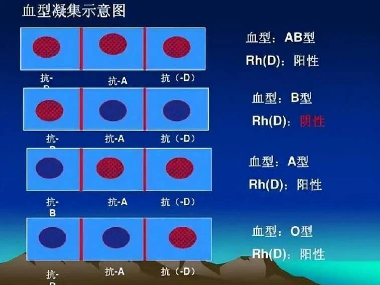 小心Ａ型血的人，四大血型壽命排行榜：AB型血平均年齡70歲，第一名出乎意料❗️