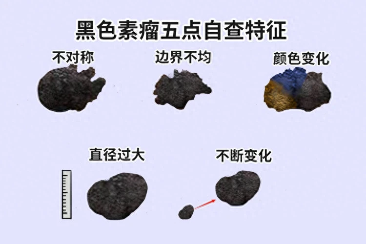 再三提醒：癌細胞轉移、擴散前，身體上通常會有4種表現，別忽視