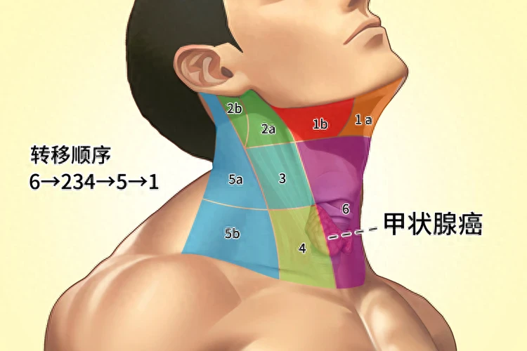 再三提醒：癌細胞轉移、擴散前，身體上通常會有4種表現，別忽視