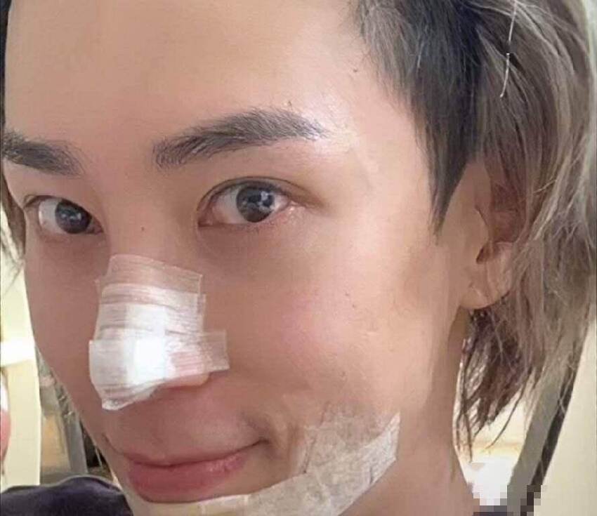 突發！香港人氣歌手馬天佑自揭整容，隆鼻墊下巴成男版芭比