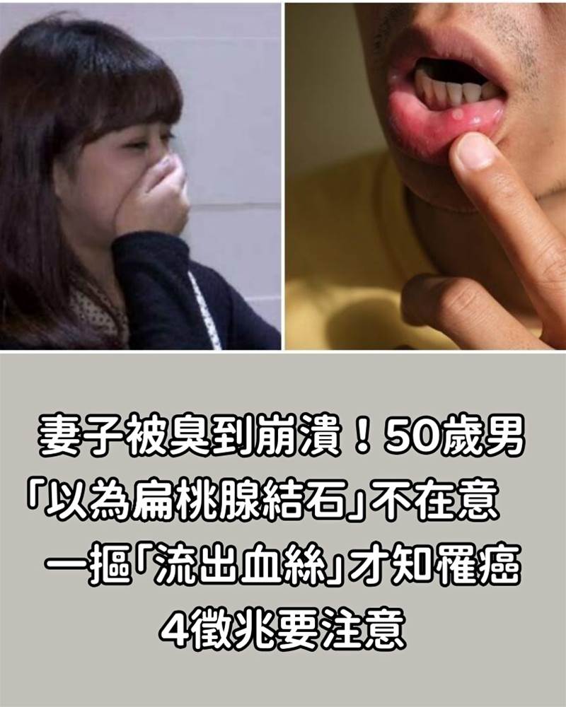 妻子被臭到崩潰！50歲男「以為扁桃腺結石」不在意　一摳「流出血絲」才知罹癌：4徵兆要注意