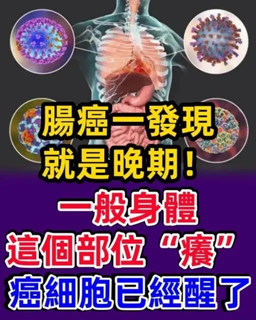 腸癌一發現就是晚期！一般身體這個部位發「癢」癌細胞已經醒了