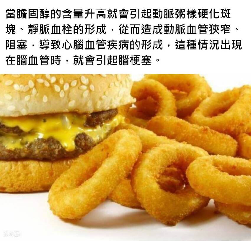 血管裡面都是「油」：記住2個食療法，膽固醇降得快又簡單