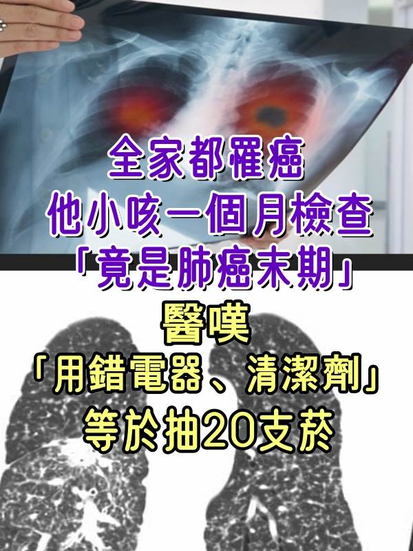 全家都罹癌！他小咳一個月檢查「竟是肺癌末期」　醫嘆「用錯電器、清潔劑」等於抽20支菸