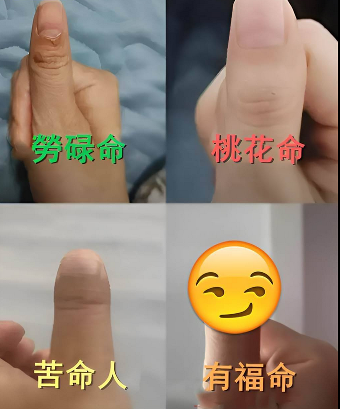 「拇指形狀」看出你是哪種命！「勞碌、桃花命」超常見…網看「有福命」跪了：太稀有