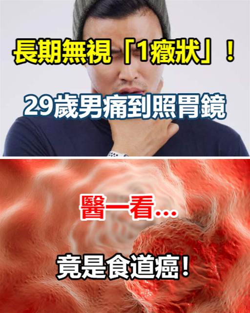 長期無視「1癥狀」！29歲男痛到照胃鏡，醫一看…竟是食道癌！