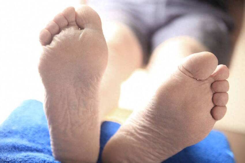 肝不好的人，手腳會有5種表現，若一個不佔，恭喜你，肝臟很健康！