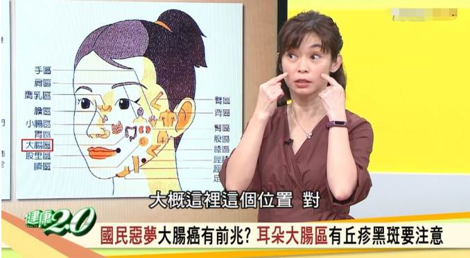 每年5千人大腸癌身亡「耳朵、臉出現1癥狀」必須快就醫！