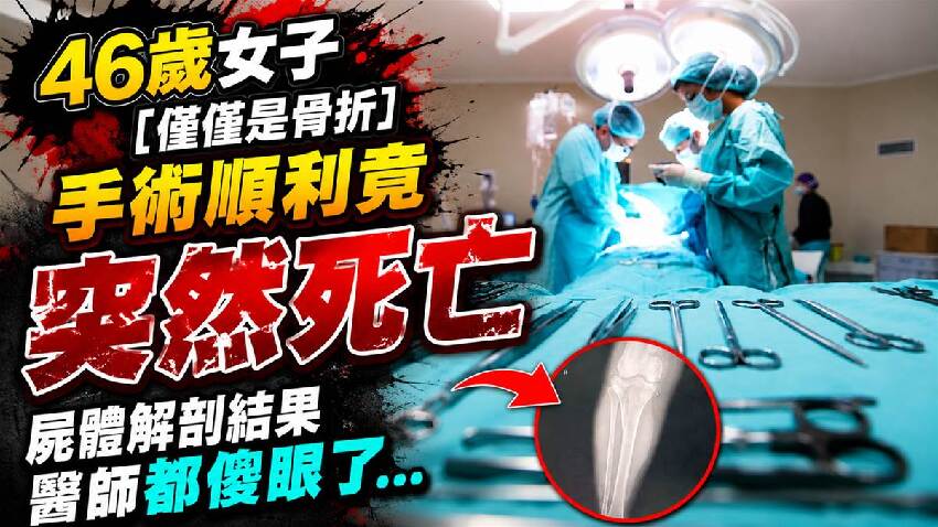 46 歲女子「僅僅是骨折」手術順利竟「突然死亡」屍體解剖結果醫師都傻眼了...