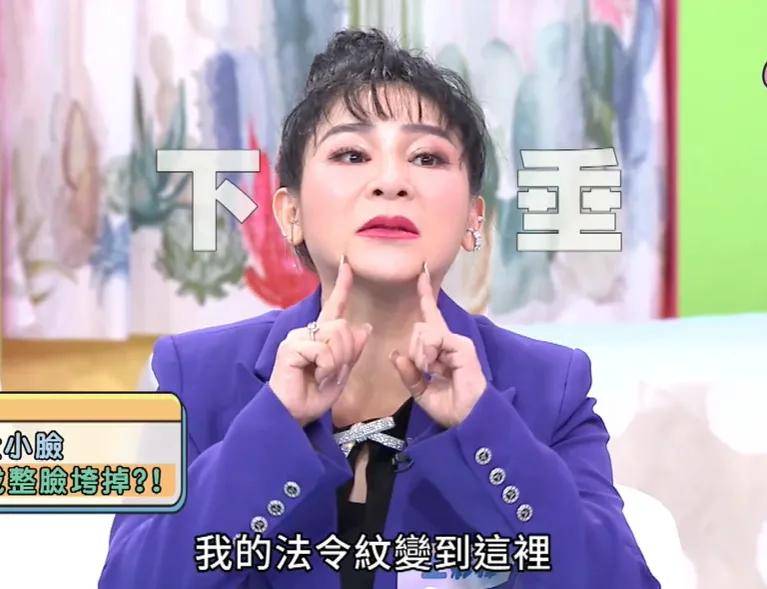 55歲女星自曝整容上癮，拉皮拉到臉歪，直言一旦打針就停不下來